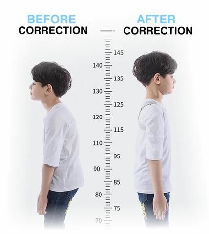 intelligent posture corrector comparison 